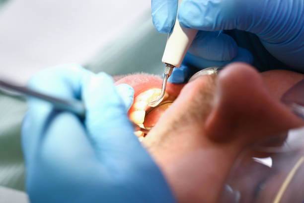 Best Emergency Dental Care for Broken or Chipped Teeth in Fordoche, LA