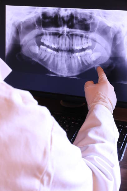 Best Emergency Tooth Extraction in Fordoche, LA