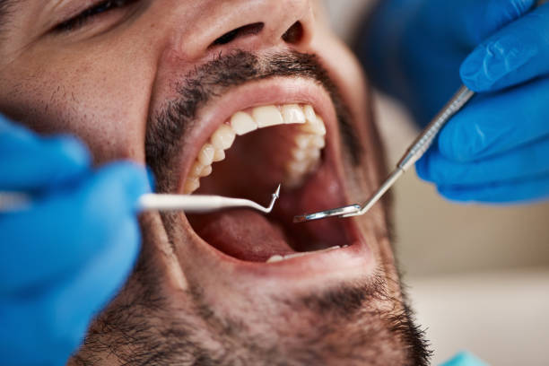 Best Same-Day Emergency Dental Services in Fordoche, LA
