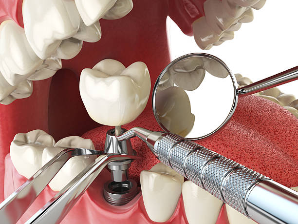 Best 24-Hour Emergency Dentist in Fordoche, LA